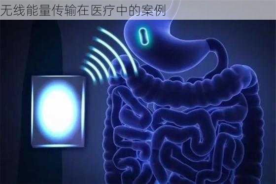 无线能量传输在医疗中的案例