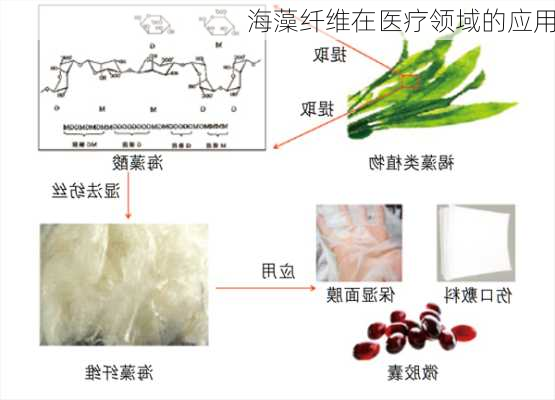海藻纤维在医疗领域的应用