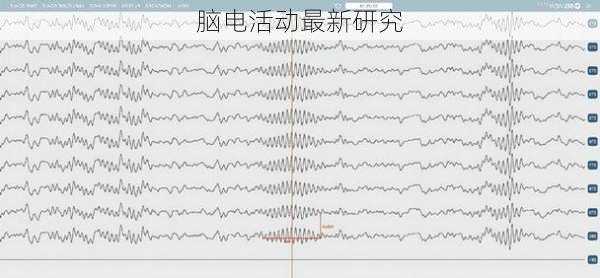 脑电活动最新研究