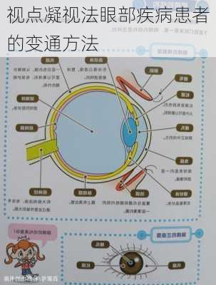 视点凝视法眼部疾病患者的变通方法