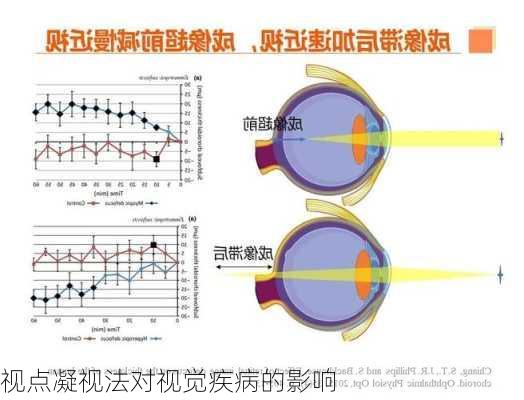 视点凝视法对视觉疾病的影响