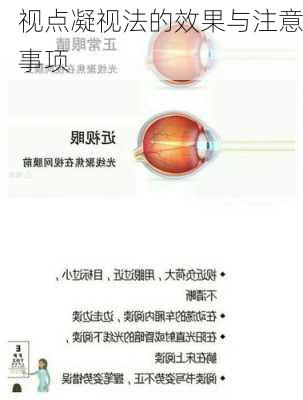 视点凝视法的效果与注意事项