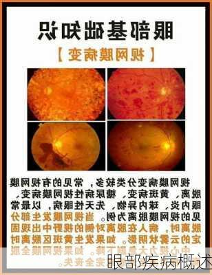 眼部疾病概述