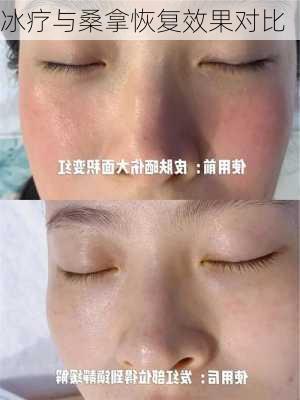 冰疗与桑拿恢复效果对比