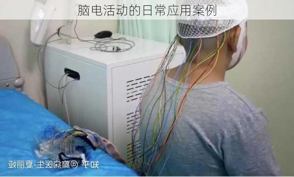 脑电活动的日常应用案例