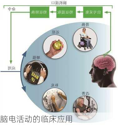 脑电活动的临床应用