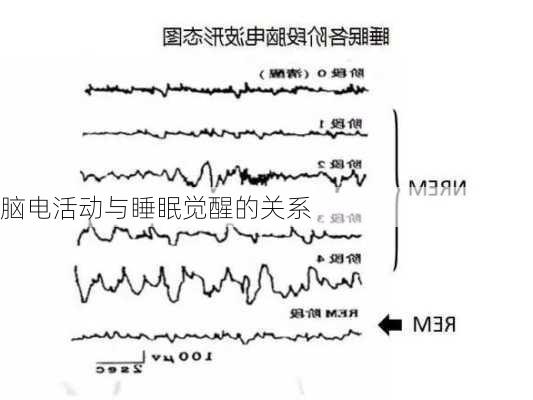 脑电活动与睡眠觉醒的关系