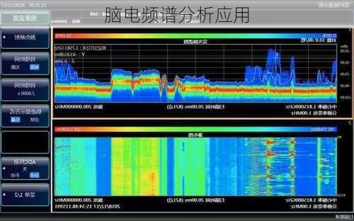 脑电频谱分析应用