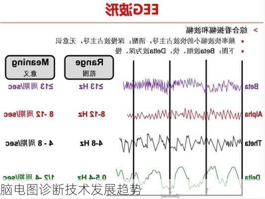 脑电图诊断技术发展趋势