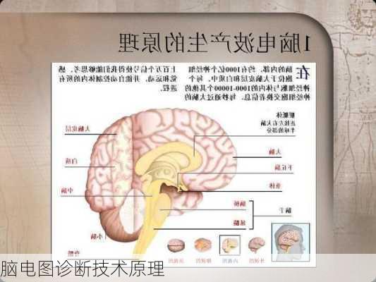 脑电图诊断技术原理