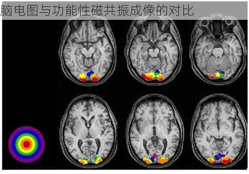 脑电图与功能性磁共振成像的对比