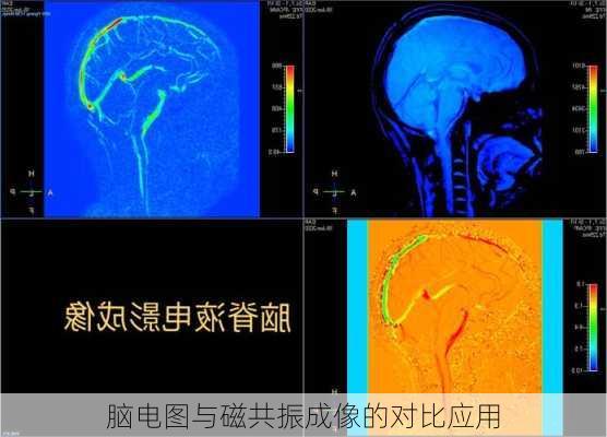 脑电图与磁共振成像的对比应用