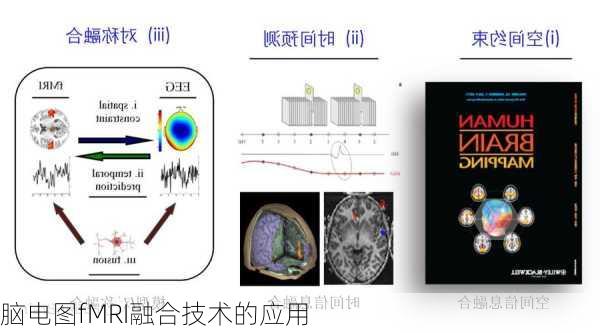 脑电图fMRI融合技术的应用