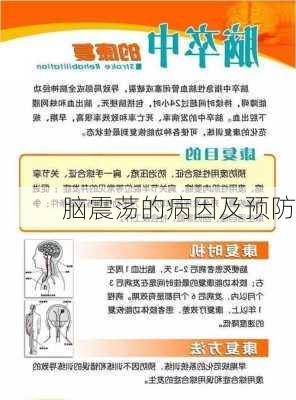 脑震荡的病因及预防