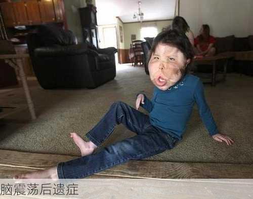 脑震荡后遗症