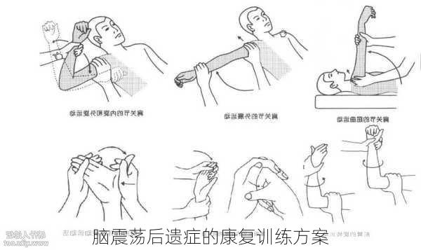 脑震荡后遗症的康复训练方案