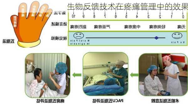 生物反馈技术在疼痛管理中的效果