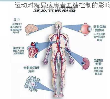 运动对糖尿病患者血糖控制的影响