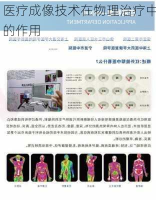 医疗成像技术在物理治疗中的作用