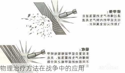 物理治疗方法在战争中的应用