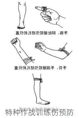 特种作战训练伤预防