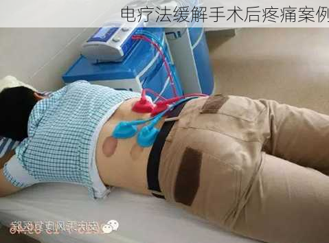 电疗法缓解手术后疼痛案例