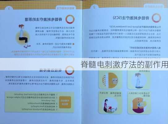脊髓电刺激疗法的副作用