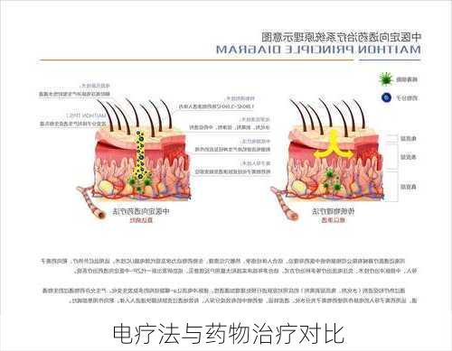 电疗法与药物治疗对比