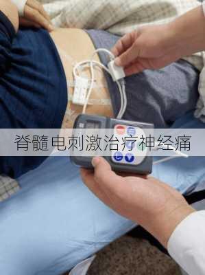 脊髓电刺激治疗神经痛