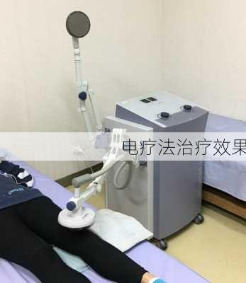 电疗法治疗效果