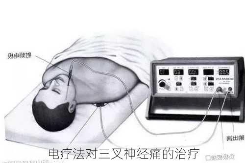 电疗法对三叉神经痛的治疗