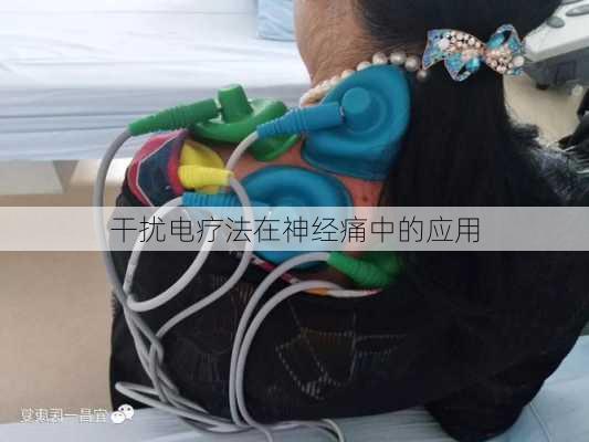 干扰电疗法在神经痛中的应用