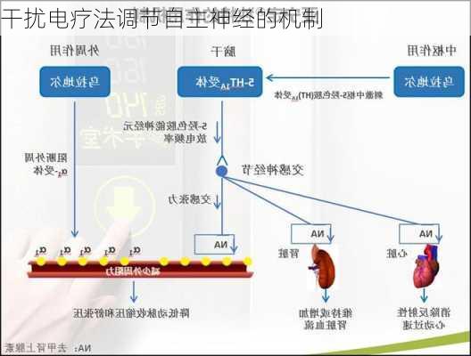 干扰电疗法调节自主神经的机制