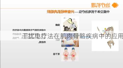 干扰电疗法在肌肉骨骼疾病中的应用
