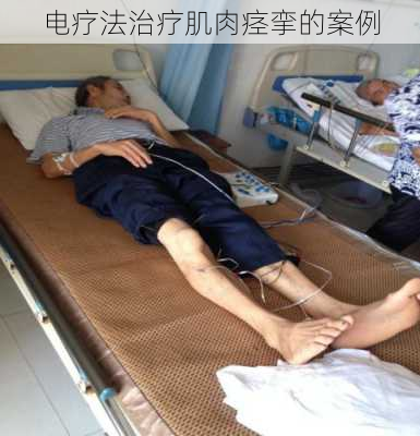 电疗法治疗肌肉痉挛的案例