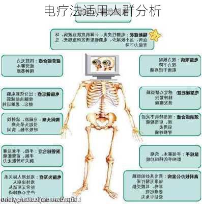 电疗法适用人群分析