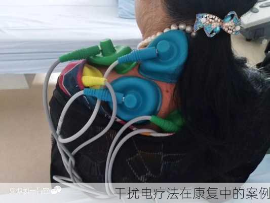 干扰电疗法在康复中的案例