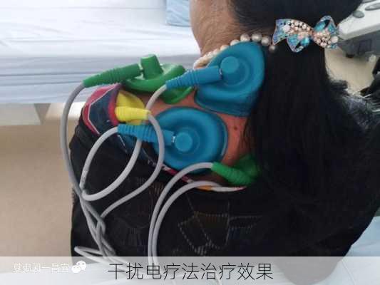 干扰电疗法治疗效果