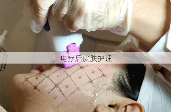电疗后皮肤护理