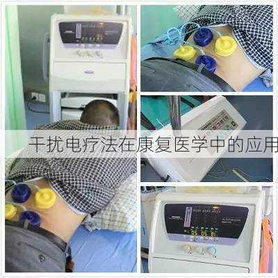 干扰电疗法在康复医学中的应用