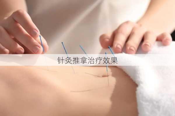 针灸推拿治疗效果