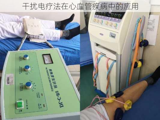 干扰电疗法在心血管疾病中的应用