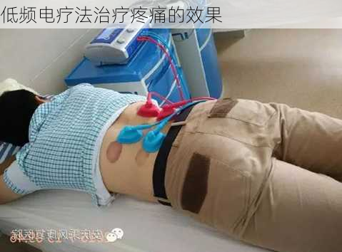 低频电疗法治疗疼痛的效果