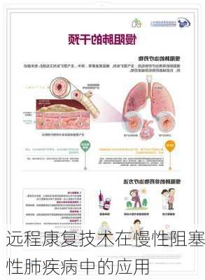 远程康复技术在慢性阻塞性肺疾病中的应用