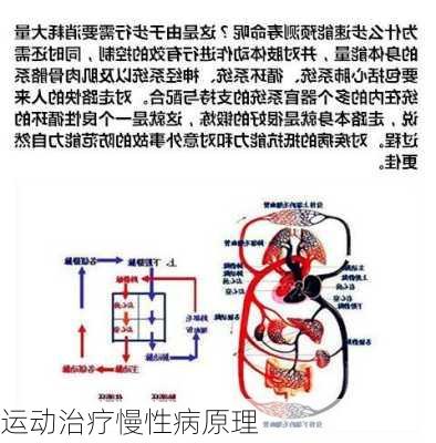 运动治疗慢性病原理