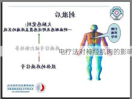 电疗法对神经肌肉的影响