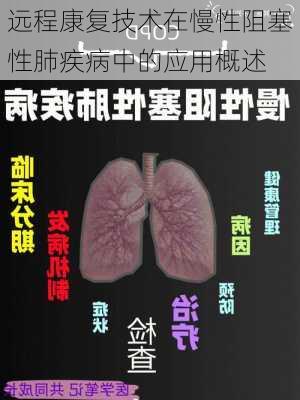 远程康复技术在慢性阻塞性肺疾病中的应用概述