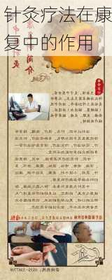 针灸疗法在康复中的作用