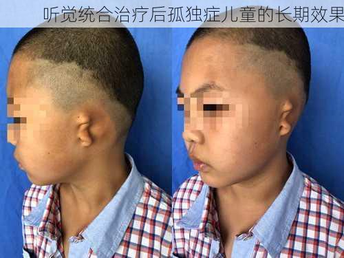 听觉统合治疗后孤独症儿童的长期效果