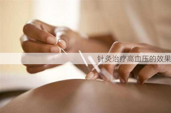 针灸治疗高血压的效果
